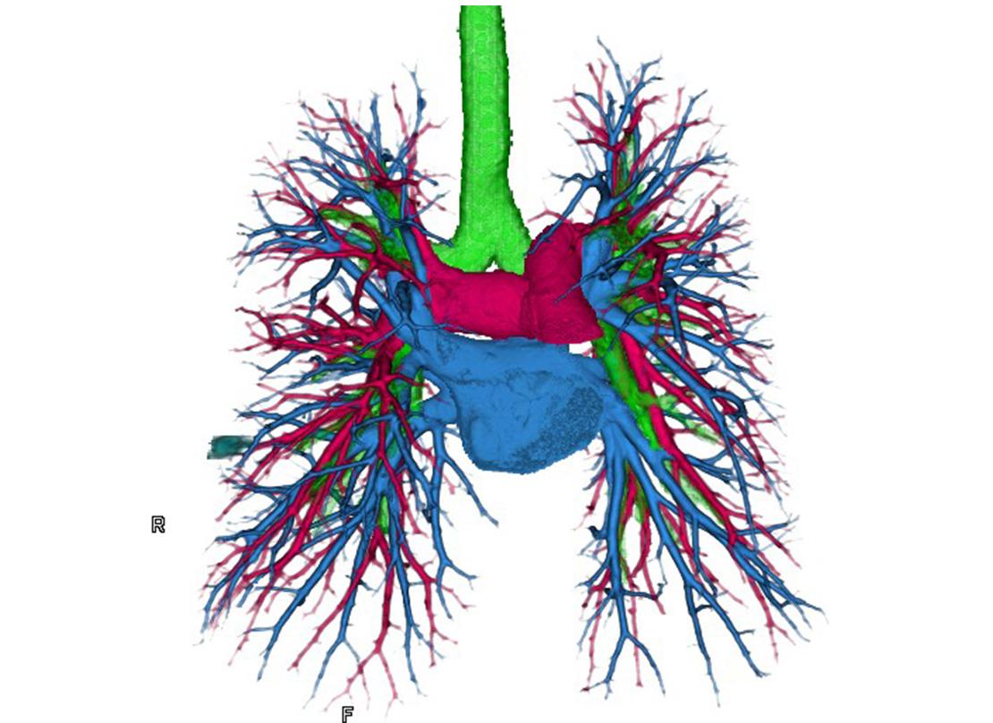 肺動静脈